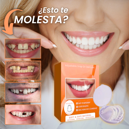 (COMPRA 1 LLEVA 2) Carillas Dentales Snap-On Smile: Tu Sonrisa Perfecta en Segundos, Sin Dentista